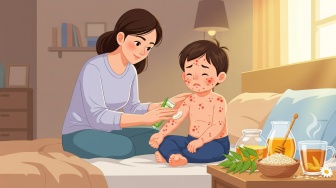 Cacar Air Sembuh Lebih Cepat dengan Obat Tradisional Ini