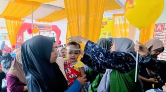 Jangan Anggap Sepele! Masalah Kulit Balita Ternyata Pengaruhi Tumbuh Kembang