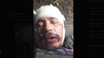 Kepala Penuh Luka, Begini Kondisi Eks Marinir Satria Kumbara Usai Dihantam Drone Kamikaze