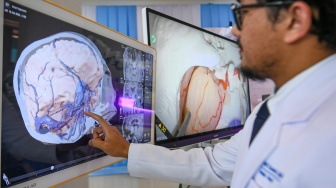 Melihat Layanan Terpadu dan Institut Neurosains RSPON yang Baru Diresmikan