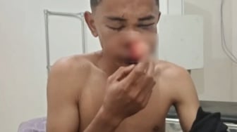 Fakta Mengerikan Polisi Aniaya Warga di NTT, 4 Oknum Ditetapkan Jadi Tersangka