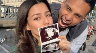 Setahun usai Menikah, Susan Sameh Umumkan Kehamilan Pertama Lewat Foto USG