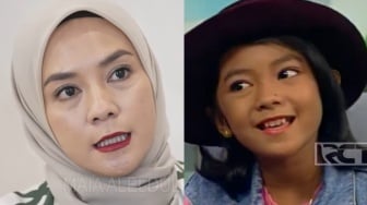 Kabar Terbaru Penyanyi Cilik Enno Lerian, Tahi Lalat di Hidungnya Hilang!