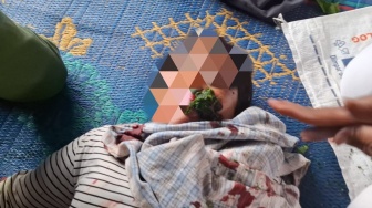 Masyarakat Adat Sihaporas Diserang Pekerja PT Toba Pulp Lestari Saat Berladang, Warga Terluka