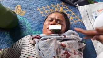 Kronologi Mencekam Sekuriti-Pekerja Toba Pulp Lestari Serbu Warga Adat Sihaporas, Ibu-ibu Dipukuli
