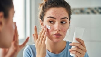 5 Sunscreen Favorit 2025 untuk Kulit Kering dan Berjerawat: Kulit Lembap Tanpa Bikin Breakout Parah!