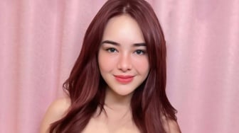 Apakah Amanda Manopo Menjalani Operasi Plastik?