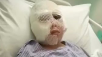 Uya Kuya Ikut Turun Tangan, Kasus Penyiksaan Brutal WNI di Malaysia Libatkan Tiga WNI