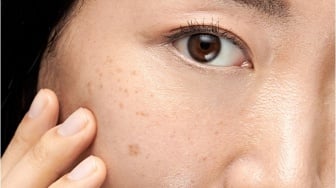 Sunscreen untuk Flek Hitam SPF Berapa? Cek 5 Rekomendasi yang Murah dan Bagus
