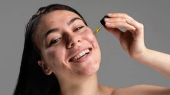4 Serum Lokal Kandungan Azeclair Terbukti Ampuh Basmi Jerawat dan Bekasnya