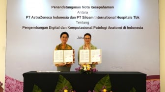 Pertama di Indonesia: Terobosan Berbasis AI untuk Tingkatkan Akurasi Diagnosis Kanker Payudara