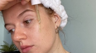 4 Ampoule Korea Calming Kemerahan dan Cegah Breakout pada Kulit Sensitif