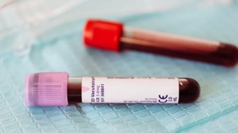 Mengenal Golden Blood: Golongan Darah Super Langka di Dunia, Cuma Dimiliki Puluhan Orang!