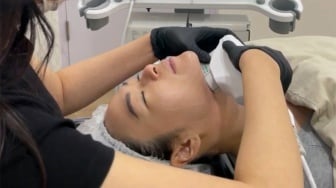 Era Baru Anti-Aging, Ini Dia Teknologi Lifting Tanpa Bedah Setara Face Lift