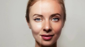 Tak Hanya Pakai Skincare, Ini 5 Cara Efektif Mengatasi Kulit Belang