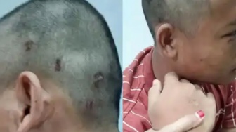 Santri di Pasuruan Babak Belur Diduga Dihajar Pengurus Ponpes, Orang Tua Lapor Polisi