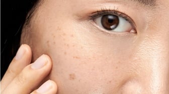 7 Bahan Alami untuk Memudarkan Flek Hitam, Bisa Ditemukan di Dapur