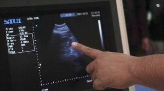 Selang Urine Tertinggal di Ginjal Pasien, Dokter RS Borromeus Divonis Langgar Disiplin