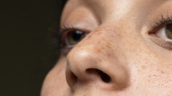 Urutan Skincare Glad2Glow Pagi dan Malam untuk Atasi Flek Hitam di Wajah