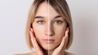 Apa Sunscreen Wardah untuk Flek Hitam? Ini 4 Pilihan Terbaik untuk Lindungi Wajah