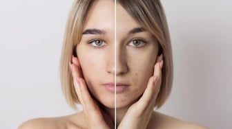 Terpopuler: Produk Viva Paling Ampuh buat Flek Hitam hingga Urutan yang Benar Pakai Retinol