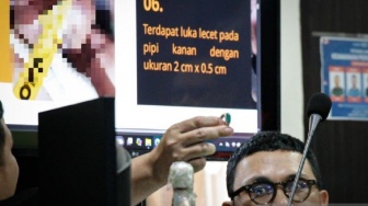 Cincin Akik Hijau Jadi Sorotan, Diduga Hantam Wajah Brigadir Nurhadi Sebelum Tewas