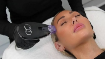 Kulit Kencang Tanpa Bedah? Bongkar Cara Kerja Morpheus8 Brust untuk Dagu hingga Paha!