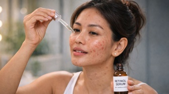 Kalau Lagi Jerawatan, Apakah Boleh Pakai Retinol? Begini Tips Amannya
