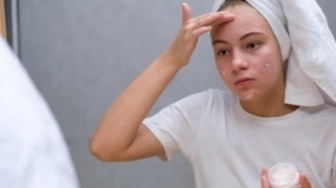 4 Pelembap Lokal Madecassoside Atasi Redness dan Dehidrasi Kulit Sensitif