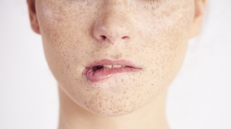 Bopeng di Wajah Bisa Hilang dengan Apa? Ini 4 Skincare untuk Perbaiki Tekstur Kulit