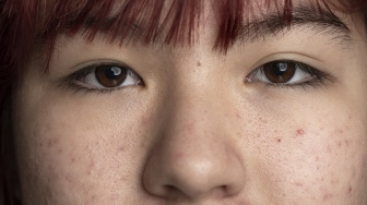 6 Produk Skincare dengan Vitamin C untuk Samarkan Flek Hitam