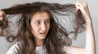 Tips Mengatasi Rambut Pitak Menurut Dokter Incognito, Hindari Kebiasaan Ini!