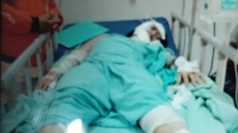 Tragedi di Makassar: Kekasih Diduga Siram Bensin, Perempuan Ini Kritis Akibat Luka Bakar