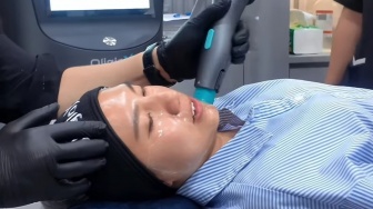 Puasa Bikin Kulit Kusam? Ini Dua Teknologi Perawatan Wajah Terbaru yang Bikin Glowing Tanpa Downtime