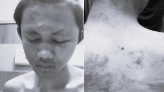 Update Kasus Kekerasan Mahasiswa UNDIP: Arnendo Terlapor Dugaan Pelecehan