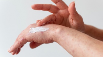 5 Rekomendasi Body Lotion untuk Menghilangkan Bekas Luka