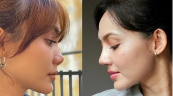 Berapa Biaya Oplas Hidung di Dokter Tompi seperti yang Dilakukan Rina Nose?