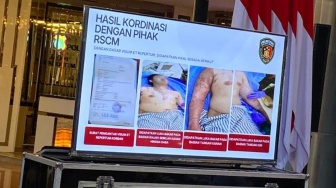 Alami Luka Bakar 20 Persen, Kemenkes Pastikan Seluruh Biaya Pengobatan Andrie Yunus di RSCM Gratis