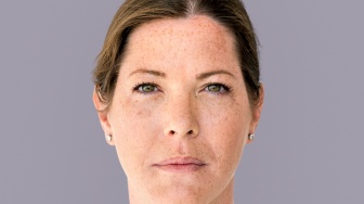 5 Pilihan Cream Penghilang Flek Hitam untuk Usia 40 Tahun di Apotek