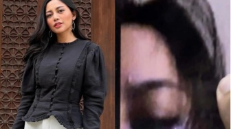Cek Fakta: Benarkah Rachel Vennya Dibogem Okin sampai Mata Lebam?