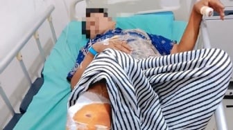 Duel Maut Lawan Beruang: Petani Karet di OKU Luka Parah hingga Dilarikan ke RS