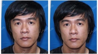 Tampang Frendry Dona, Bos Lab Vape Narkoba Buron yang Manfaatkan Celah Sistem Ojol!