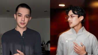 Rey Mbayang Idap Autoimun Psoriasis, Alami Kerontokan Rambut Parah