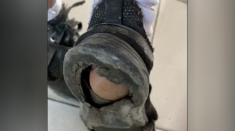 Bikin Mewek! Viral Video Sepatu Siswa SD di Samosir Banyak Tak Layak Pakai