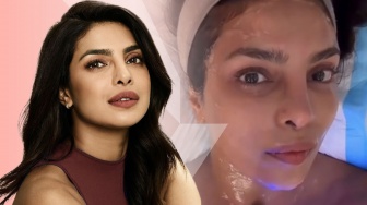 XERF Jadi Treatment Pilihan Priyanka Chopra Jonas, Kulit Kencang Natural Tanpa Operasi