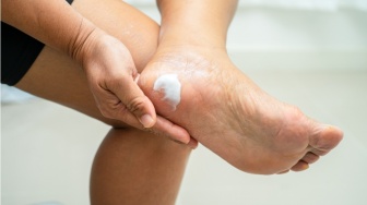 Tumit Kasar Jadi Mulus: Ini 5 Foot Cream Andalan untuk Kulit Pecah-Pecah!