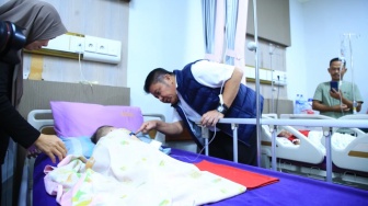 Sambut HUT Sumsel ke-80, Bank Sumsel Babel Bantu Anak Bibir Sumbing Kembali Tersenyum