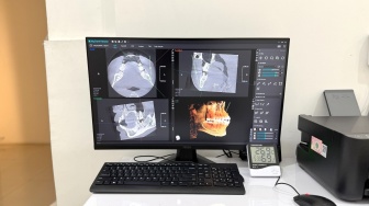 Mengenal Rontgen Gigi 3D: Teknologi yang Bantu Diagnosis Lebih Akurat dan Cepat