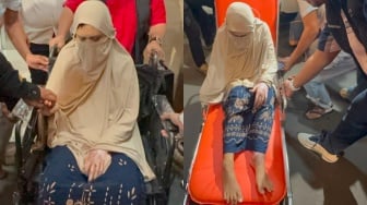 Luka Bakar 47 Persen! Istri Siri Dipaksa Anggota Polisi Buat Sabu hingga Disiram Air Keras