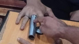 Pemuda di Batam Alami Insiden Tak Terduga, Jari Tersangkut di Shock Motor Saat Iseng